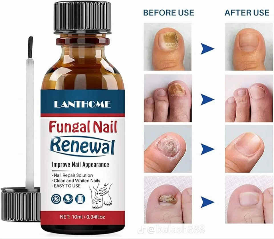 Comment retrouver des ongles saints de manière naturelle (même si vous souffrez depuis des années)