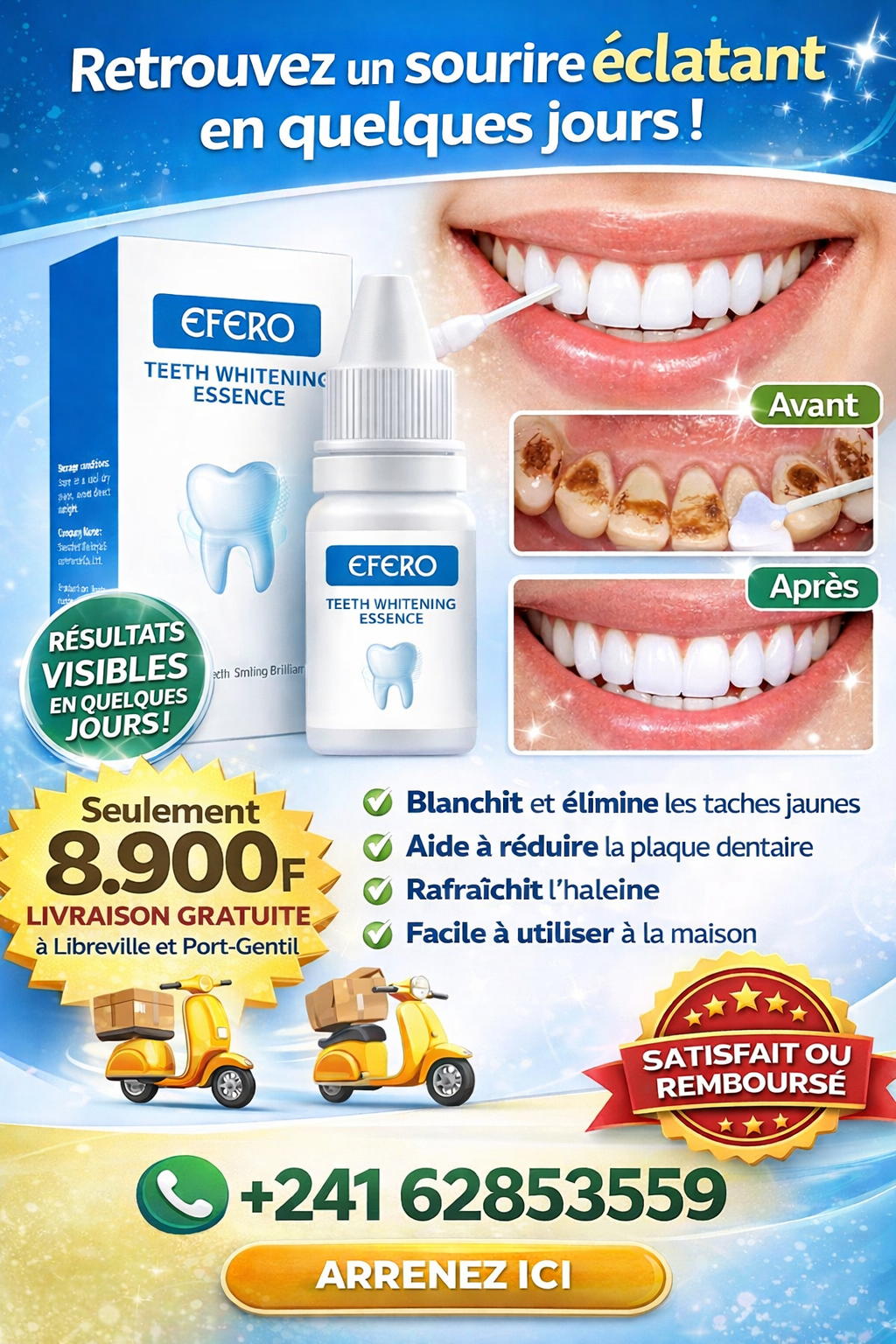 Avec EFERO retrouvez un sourire éclatant en quelques jours !